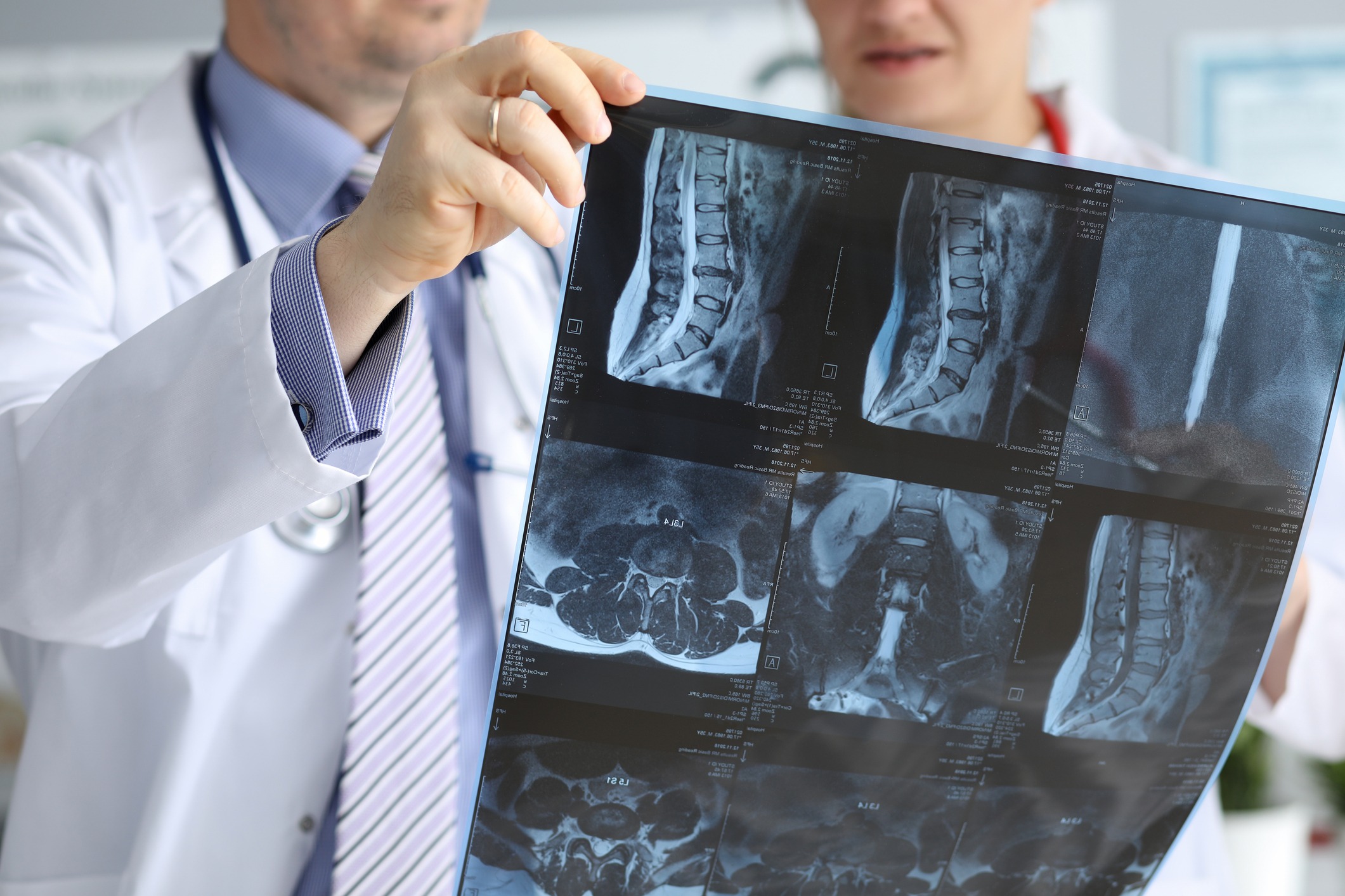 Fort Lauderdale spinal cord injury attorney 
